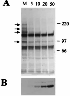 FIG. 1. HSV-1 infection stimulates the loss of several high-molecular-weightPML isoforms