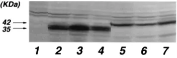 FIG. 6. Western blot analysis of GAL-Rex and Rex-VP fusion protein ex-pression in HeLa cells