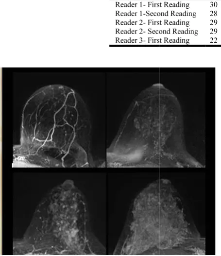 Figure 1. Examples of varying amounts of BPE, as prospectively assessed qualitatively