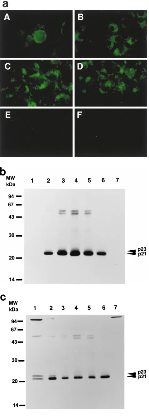 FIG. 2. Time course of changes in expression of HCV core protein. (a) In-direct immunoﬂuorescence microscopy