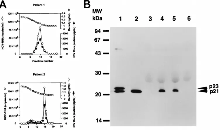 FIG. 7. (A) Quantiﬁcation of HCV core protein and HCV RNA in fractions from sucrose density gradient centrifugation of the patient sera