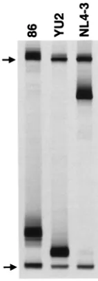 FIG. 2. Analysis by V3-HTA. V3 loop RT-PCR products from the June 1986serum sample from patient UNC116 (lane 86) and control YU-2 and NL4-3