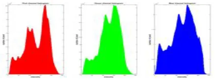 Figure 2. Steps for Jaundice detection 