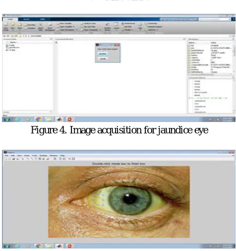 Figure 4. Image acquisition for jaundice eye 