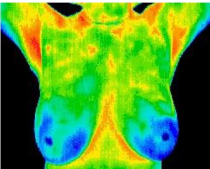 Figure 1. Ordinary Thermal Image 