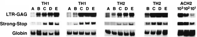 FIG. 5. HIV-1 DNA detection in Tby reverse transcription (141 bp of the minus strong-stop strand)