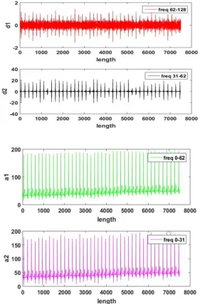Figure 6: Original and filtered ECGs comparison 