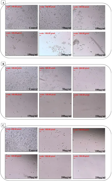 Figure 2. Microscopicview of HCT-116 cellsafter 24 (A), 48 (B) and 72 hours (C) of incubation with increasing concentrations (50, produced by maceration extraction technique