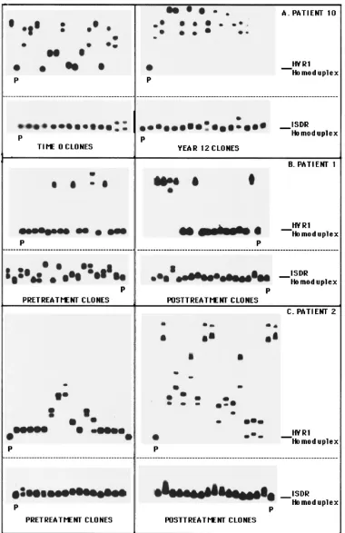 FIG. 2. Clonal frequency analysis of the temporal changes in HCV quasispecies in the HVR1 and ISDR