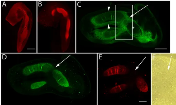 Figure 1. Immunolocalization of versican in relation to chondrogenic tissue in the developing chick limb