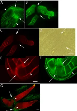 Figure 2: Immunolocalization of versican in relation to chondrogenic tissue in the developing chick limb
