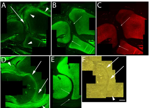 Figure 3: Immunolocalization of versican in seen at earlier stages, strong aggrecan (B,E) and type II collagen (C) expression remain in all areas of the cartilage anlagen except for those versican positive regions along the developing articulation (small a