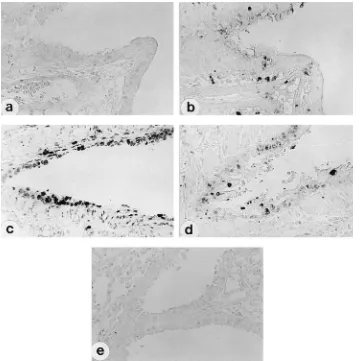 FIG. 5. Detection of apoptosis in lungs of mice infected with SeV. Three-week-old male ICR mice were inoculated intranasally with 1.25 �(a and b) or MVC11 (c and d) in 25 105 CIU of either M1 �l of PBS or with 25 �l of PBS as a control (e)