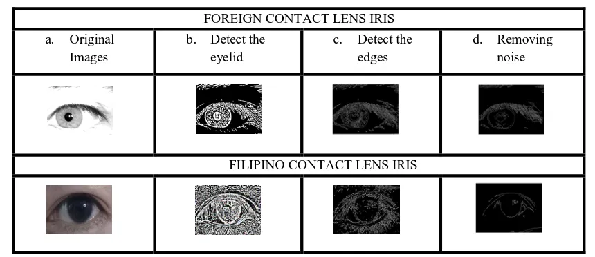Fig 6 Segmentation Image of Normal Eye: (a). Source image, (b.) detecting eyelid using sobel algorithm, (c) detecting edges using canny edges algorithm, (d.) removing noise in an image 