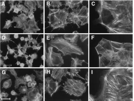 FIG. 7. F-actin organization of E1A-immortalized epithelial cells versus E1A-plus-v-srcdescribed in Materials and Methods