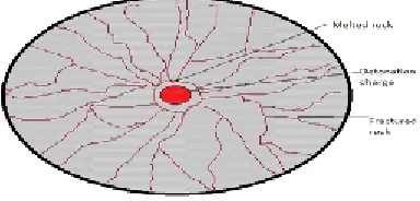 Fig. 7. Effect of detonation on a rock section