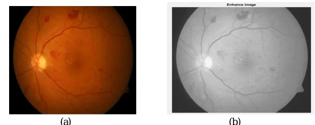 Figure 10. (a) Input Image (b) Enhance Image 