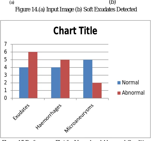 Figure 14.(a) Input Image (b) Soft Exudates Detected 