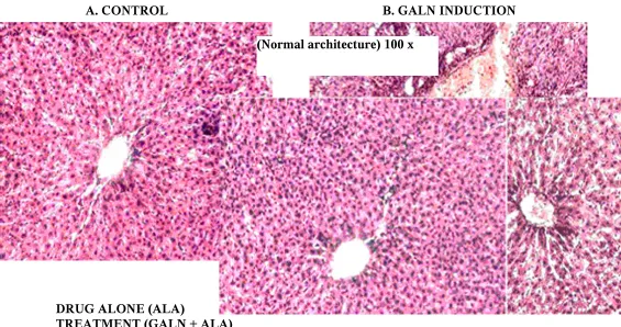 FIG. 9 – EFFECT OF ALPHA LIPOIC ACID AND D-GALACTOSAMINE