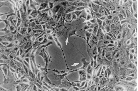 FIG. 1. VV-induced plaques contain cells with motile features. Monolayers of BS-C-1 cells were infected with VV strain WR at 0.01 PFU/cell, and the plaquemorphology was examined at 36 hpi by phase-contrast microscopy