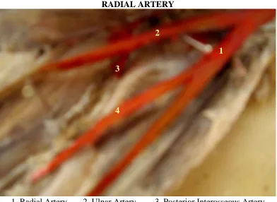 FIG – 41 ORIGIN OF COMMON INTEROSSEOUS ARTERY FROM RADIAL ARTERY 