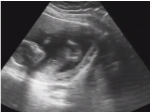 Figure 1.1:Look! Do you see those tiny feet?
