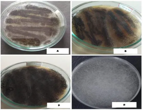Fig .1 shows the fungal isolates cultivated on sabouraud’s agar plates.  The soil samples collected from different areas were screened on  sabouraud’s agar plate which shows the presence of 4 isolates such as Isolate-A, Isolate-B, Isolate-D and Isolate- R 