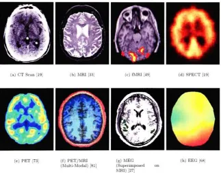 Figure 2.50.3ComputerdamagetheactivityNeurons' mm brain's depicts spatial resolutions for different brain imaging techniques