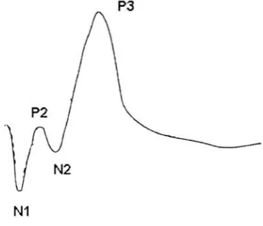 Figure 2.9: P300 waveform.