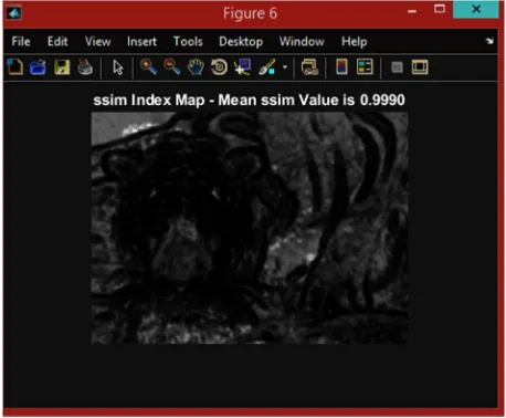 Fig. 11 shows the output of Structural SIMilarity index map image for the value 0.9990