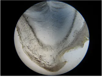 FIGURE .5GENERATION OF THICK CEMENTUM