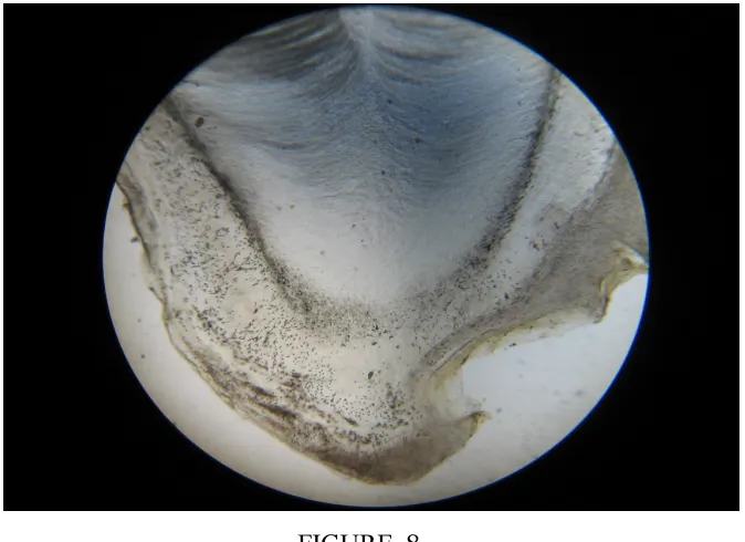 FIGURE .7SPOTTED  LIKE   RESORPTION