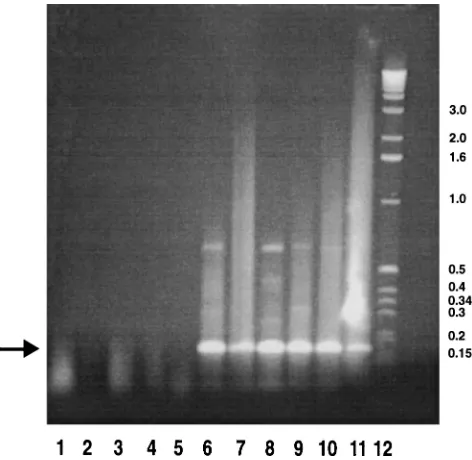 FIG. 1. Analysis of expression of the MyD116 conserved domain in a rangeof tissues and cell types