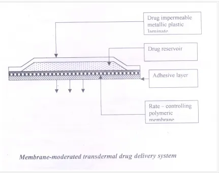 Figure No.4 Membrane Moderated System