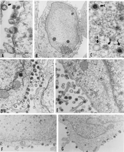 FIG. 5. Electron micrographs of cells infected with wild-type HSV-1(F), ULextracellular virions
