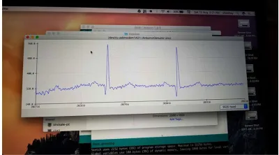 Fig. 8. Sample ECG readings