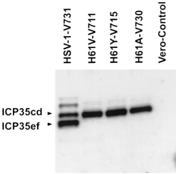 FIG. 2. N antibody, Western blot analysis of H61 mutant virus-infected Verocell extracts
