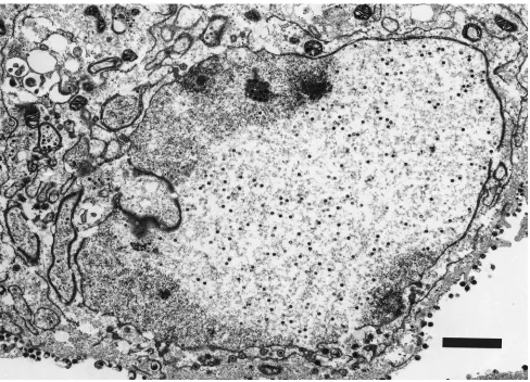 FIG. 8. TEM of Vero cell infected with HSV-1-V731 20 h postinfection. Magniﬁcation, �9,600