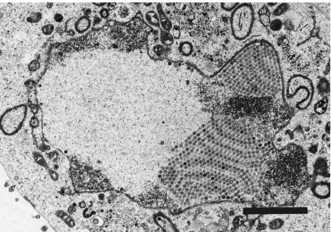 FIG. 9. TEM of Vero cells infected with H61A-V730 20 h postinfection. Shown are nuclear B capsids