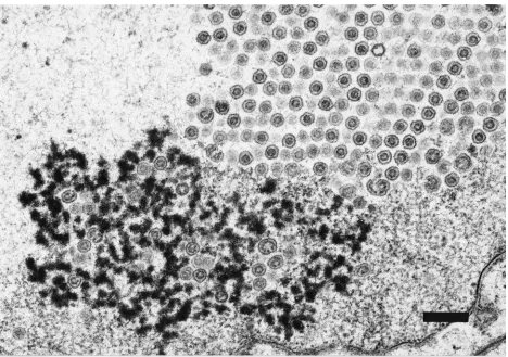 FIG. 10. TEM of Vero cells infected with H148E-V728. (A) Crystal-like arrays of B capsids lining the nuclear membrane
