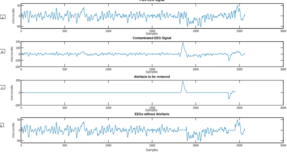 Fig 5: Eye movement artefact shown in window 