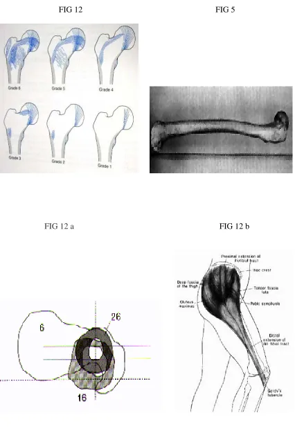 FIG 12                                                                FIG 5 