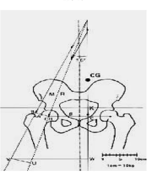FIG 16  