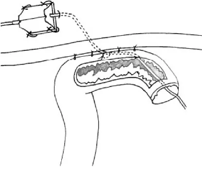 Figure No.1   