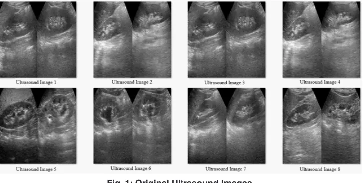 Table 1: Comparison of muscle imaging modalities, adapted from Clague et al2