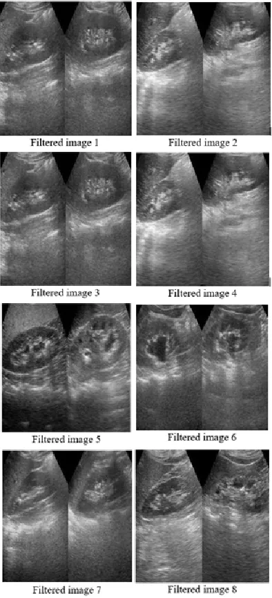 Fig. 3: Filtered images after application of Anisotropic Diffusion