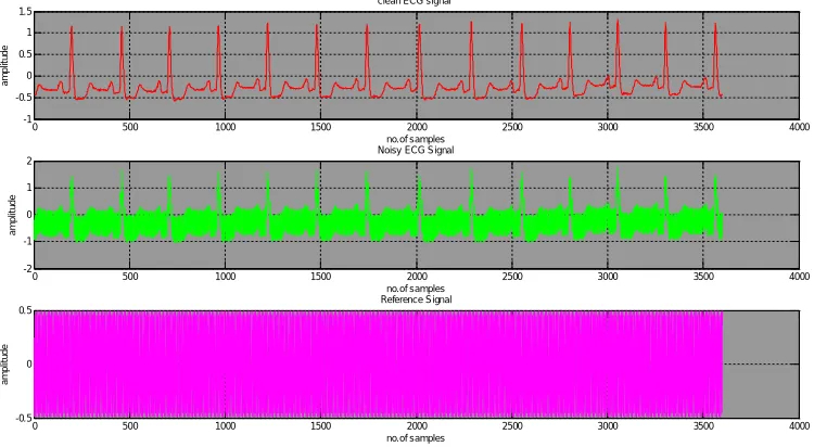 Table.6 shows the performance of SSLMS, TSLMS, SSSLMS, TSSLMS, SSSSLMS, TSSSLMS, SSSRLMS, and TSSRLMS algorithms in terms of distortion