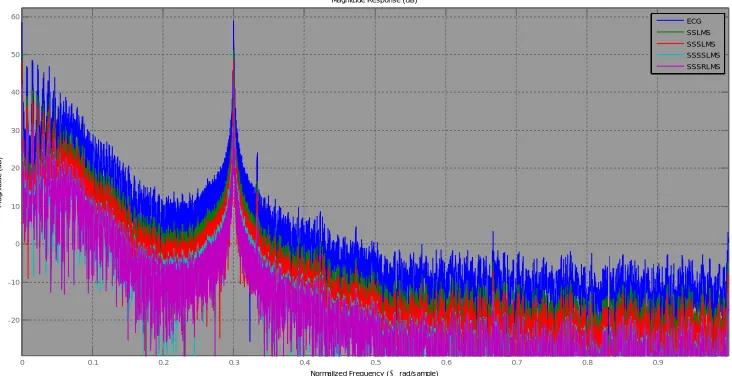 FIGURE 5: Frequency Spectrum of ECG Signal with PLI for MIT-BIH Record Number 105 using Single Stage Adaptive  algorithms 