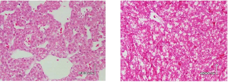 Fig. 5: Control Group: a) Day 10 b) Day 15. Histology of liver showing normal hepatocytes arranged in rows, forming central vein, sinusoids and scattered RBCs