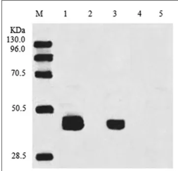 Fig 2. Subcellular localization of MucACP-Δ9D in transgenic tobacco. A representative western blot of transgenic tobacco indicating the discrete localization of MucACP-Δ9D in the chloroplast